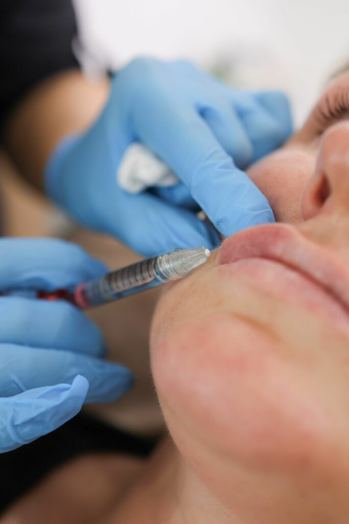 Lip Fillers, Anti-Wrinkle Injections in South Godstone RH9