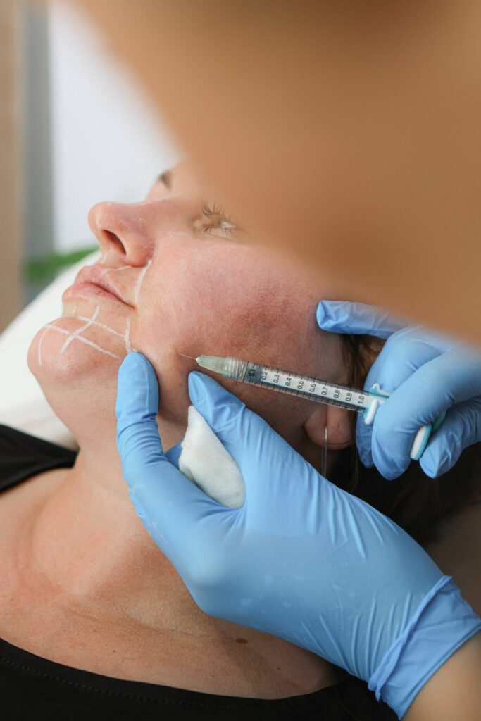Lip Fillers, Anti-Wrinkle Injections in Sunbury TW16